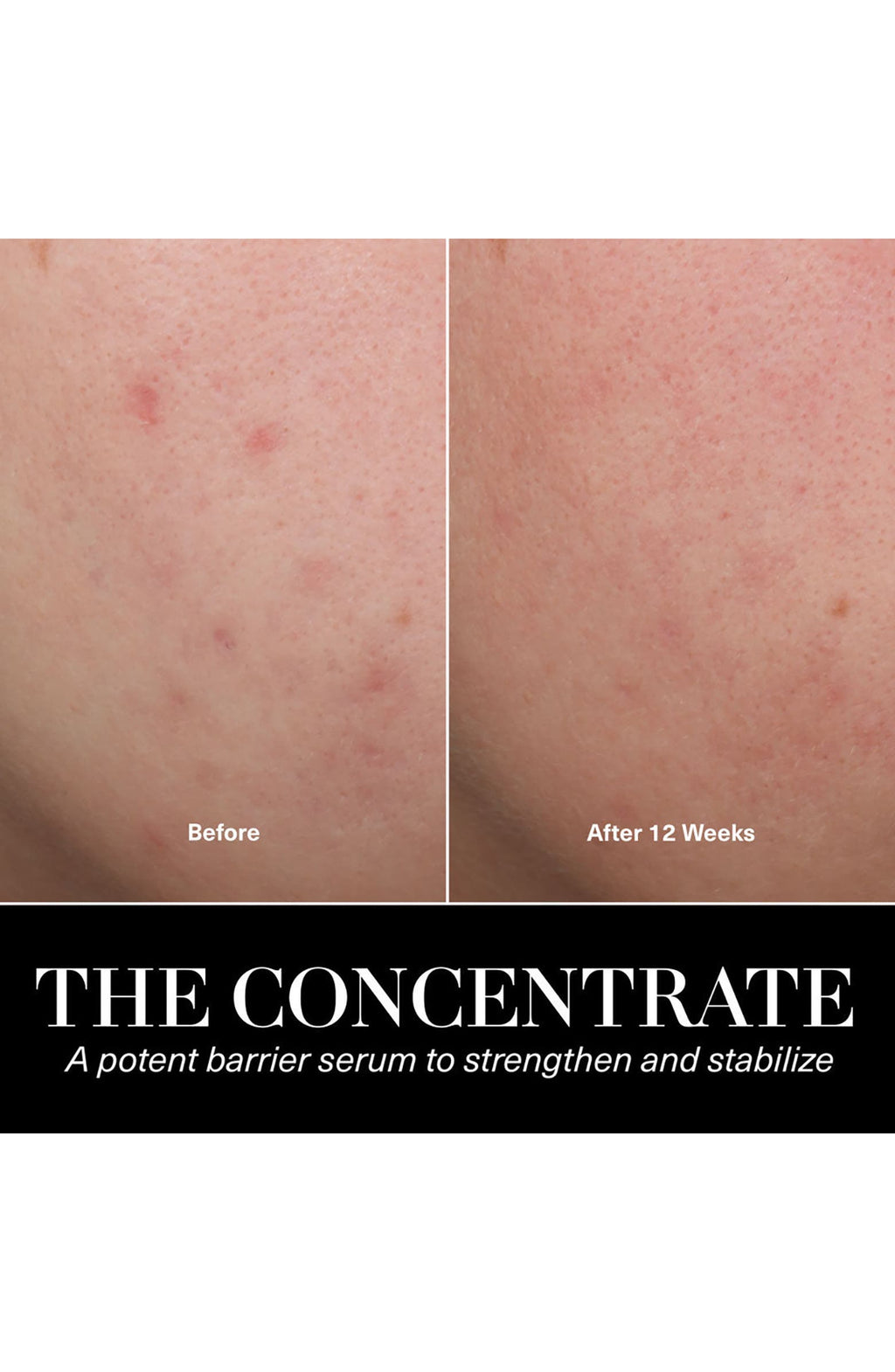 The Concentrate Serum for Barrier Repair & Hydration