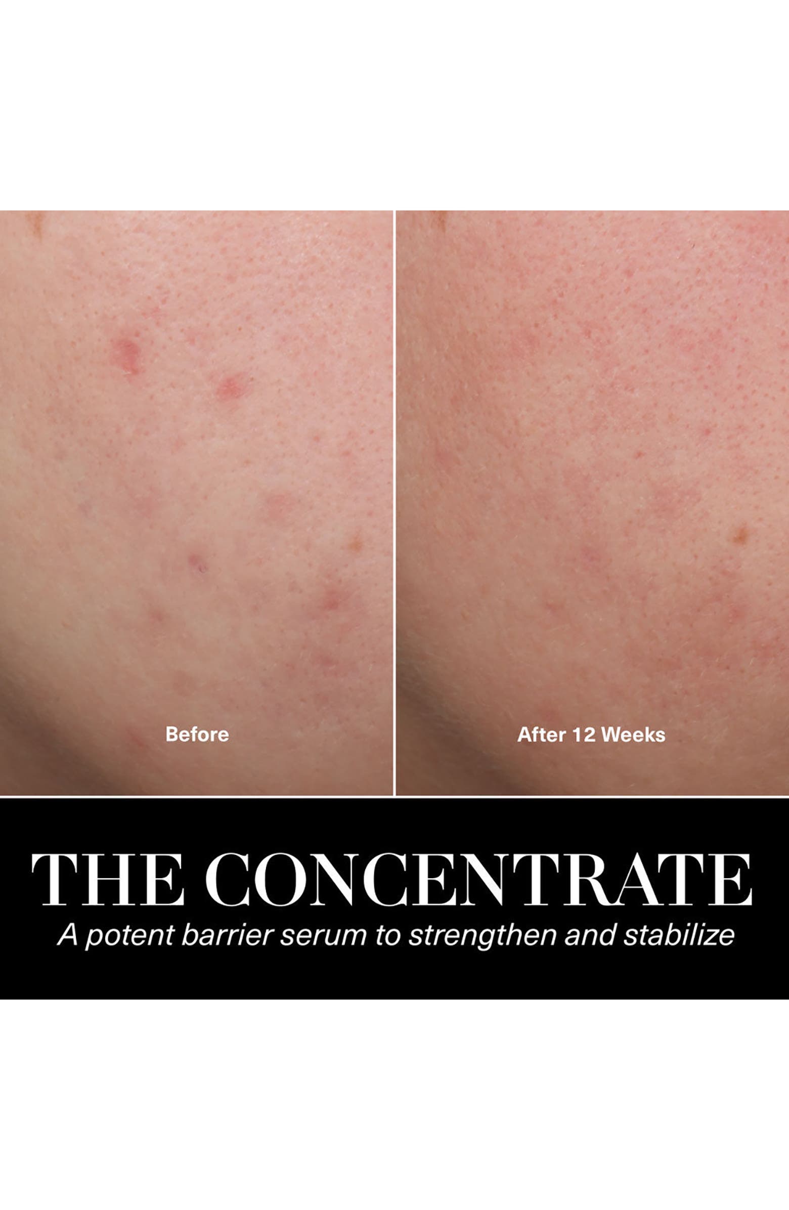 The Concentrate Serum for Barrier Repair & Hydration