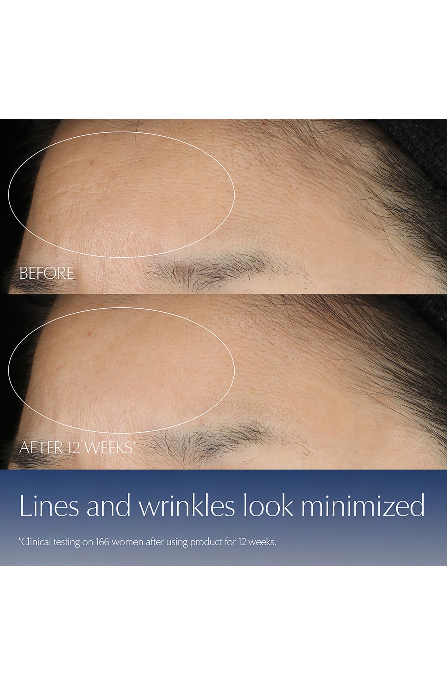 Advanced Night Repair Synchronized Multi-Recovery Complex Serum with Hyaluronic Acid & Peptides-1.7oz