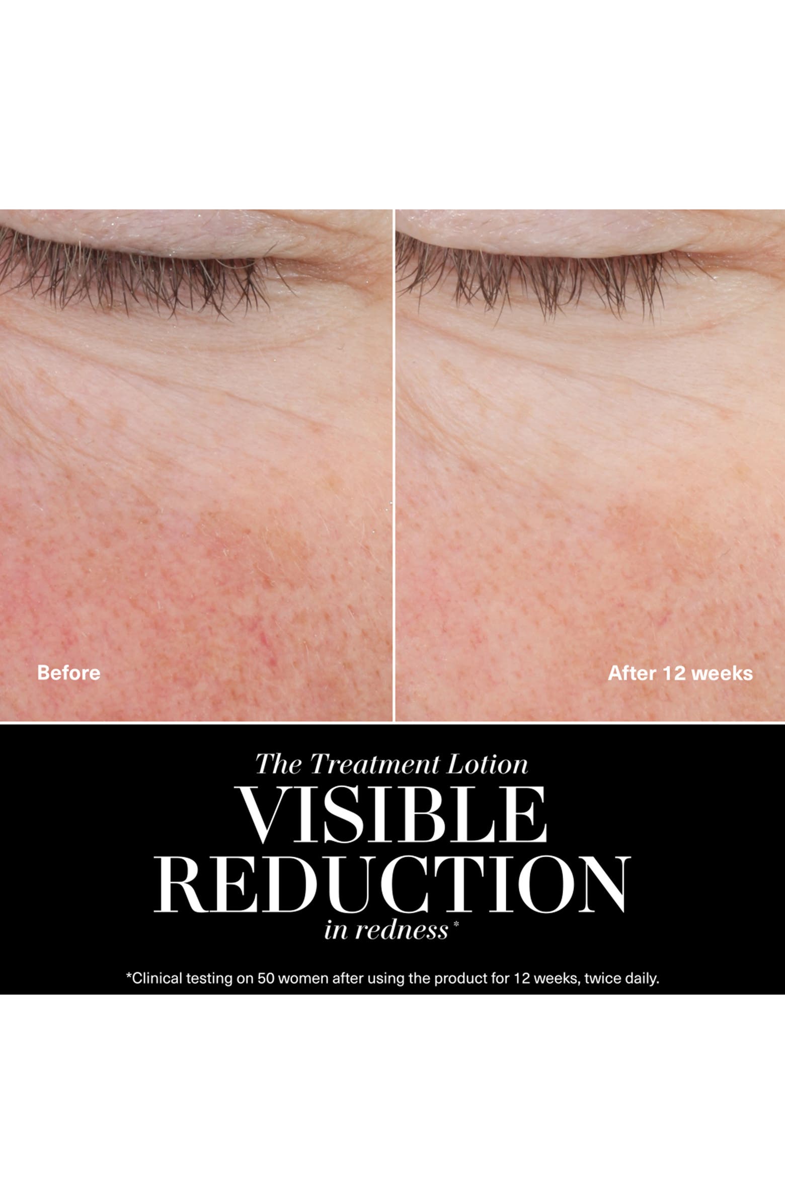 The New Treatment Lotion for Hydration & Anti-Aging