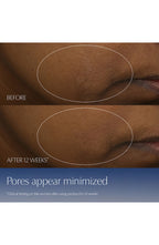 Advanced Night Repair Synchronized Multi-Recovery Complex Serum with Hyaluronic Acid & Peptides-1.7oz