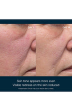 Dynamic Resurfacing Facial Pads-14count