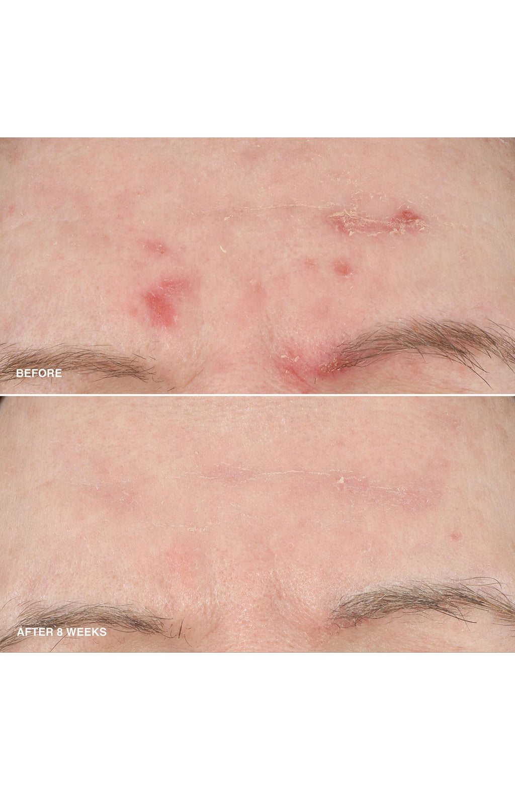 Vitamin Enriched Smoothing Niacinamide + Vitamin C Serum