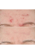 Vitamin Enriched Smoothing Niacinamide + Vitamin C Serum