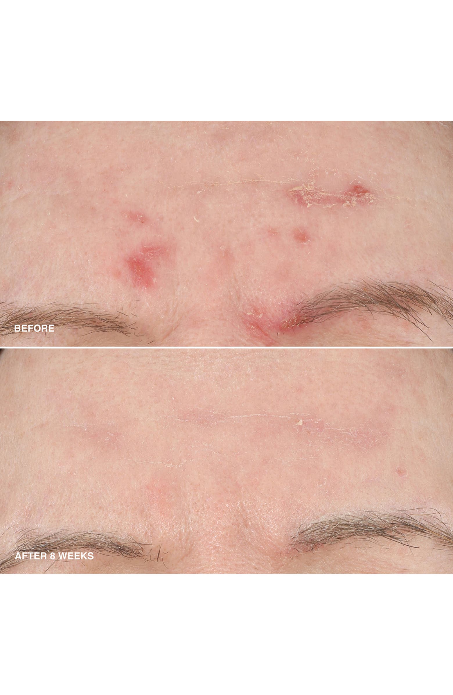 Vitamin Enriched Smoothing Niacinamide + Vitamin C Serum