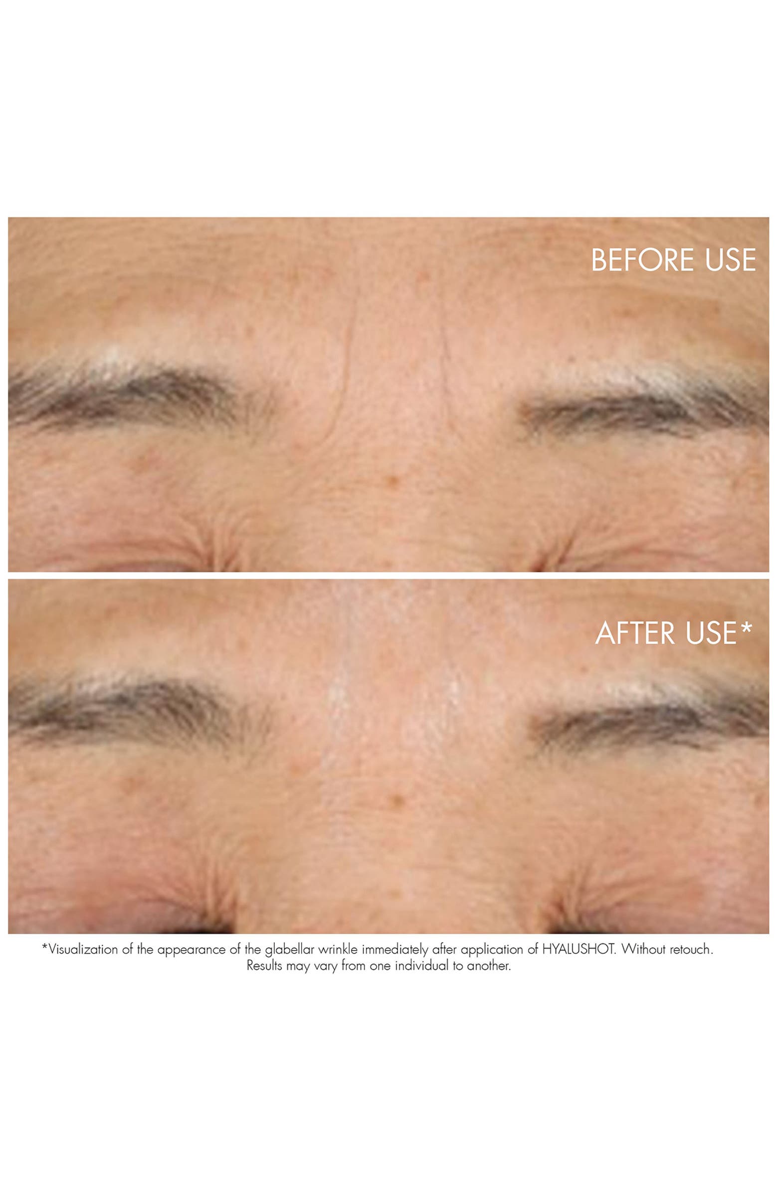 Capture Totale Hyalushot: Wrinkle Corrector with Hyaluronic Acid