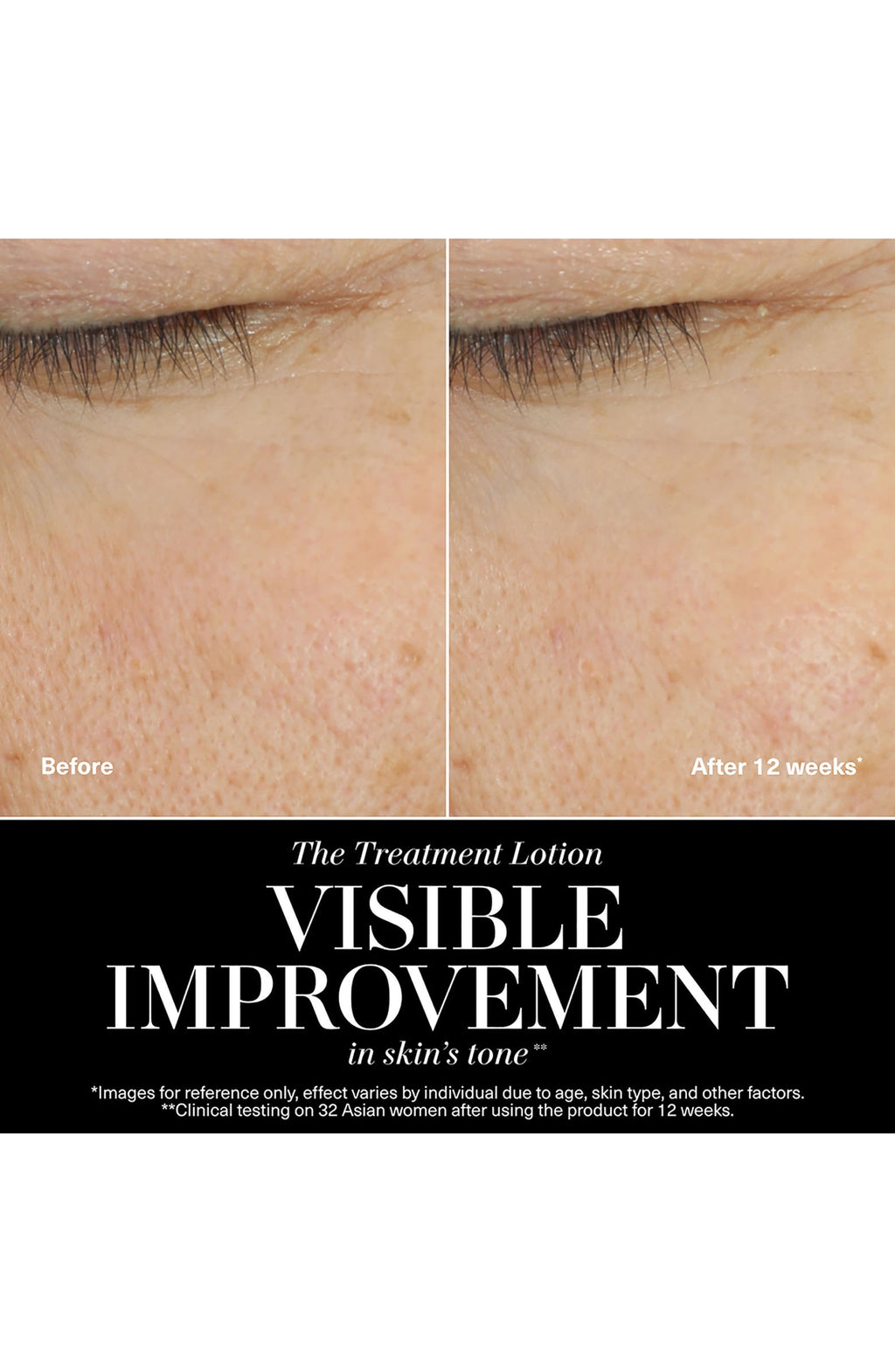 The New Treatment Lotion for Hydration & Anti-Aging